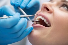 Drew Jobs Dental Assistant Posted by Joseph Zichella DMD LLC for Drew University Students in Madison, NJ